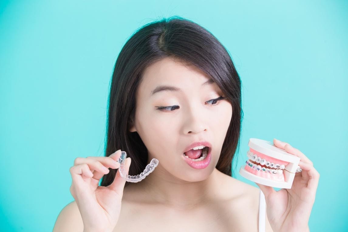 Invisalign vs Braces