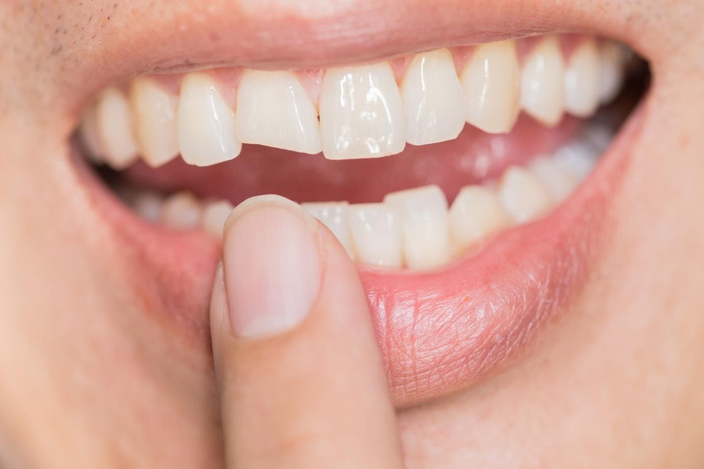 Tooth Repair 101