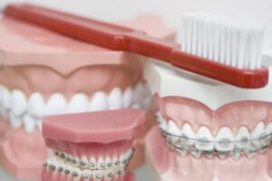 Perfecting Your Smile