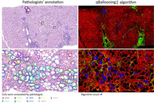 HistoIndex and Global Liver Experts Advance Stain-free