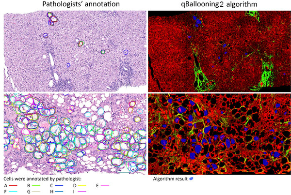 HistoIndex and Global Liver Experts Advance Stain-free